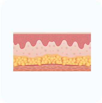 Follicular Unit Transplantation (FUT)