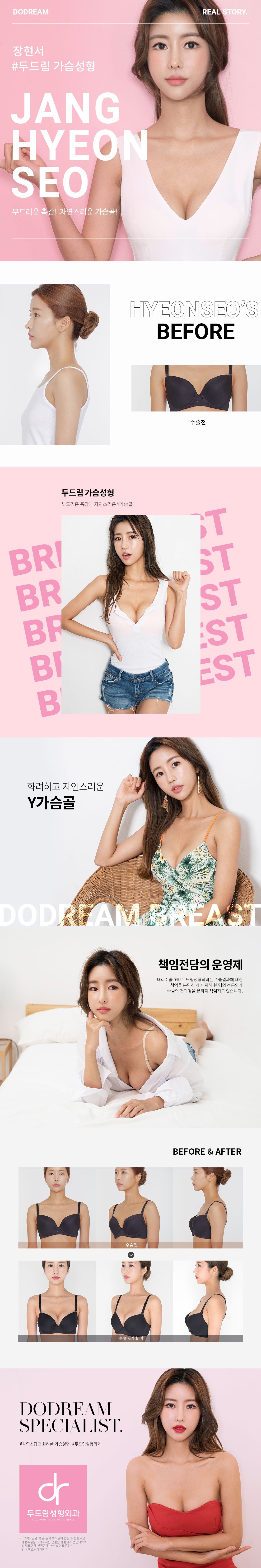 190708_장현서(가슴성형)_리얼스토리.jpg