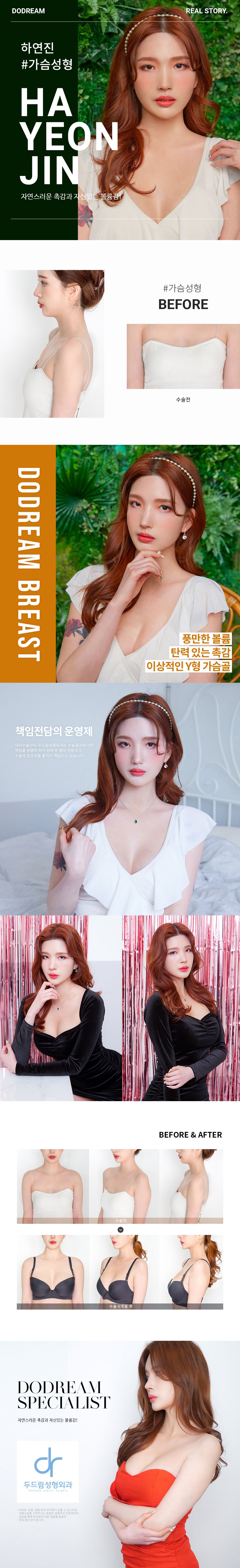 201218_하연진(가슴)_리얼스토리.jpg