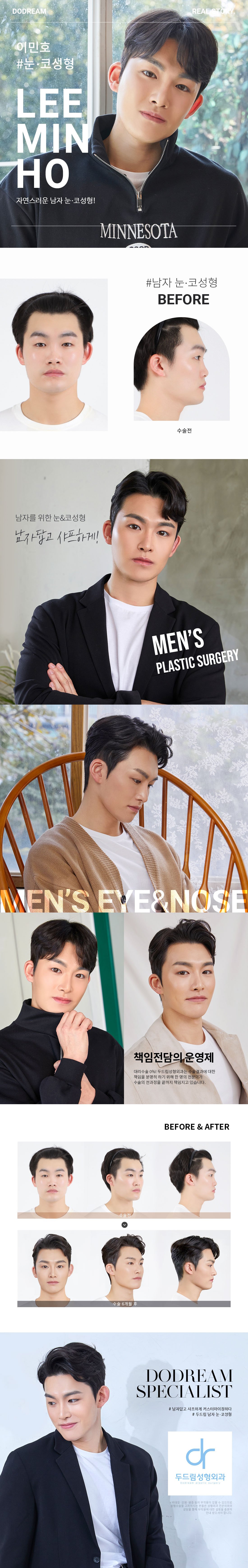 200601_이민호(눈,코)_리얼스토리.jpg