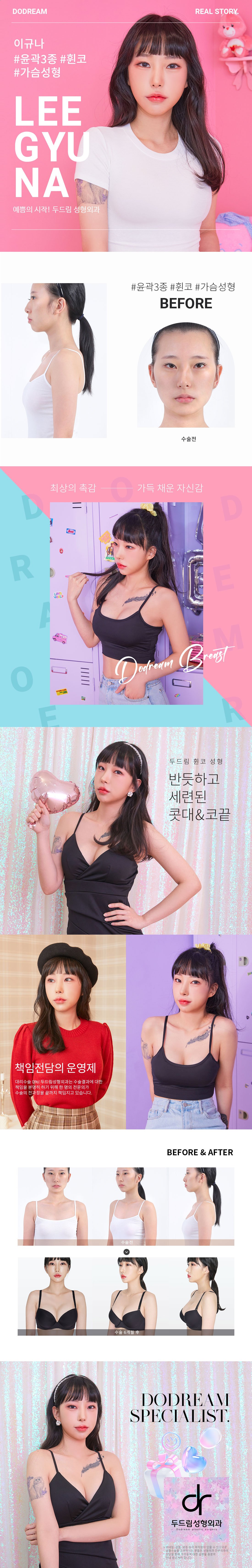 200325_이규나(윤곽3종,휜코,가슴)_리얼스토리.jpg