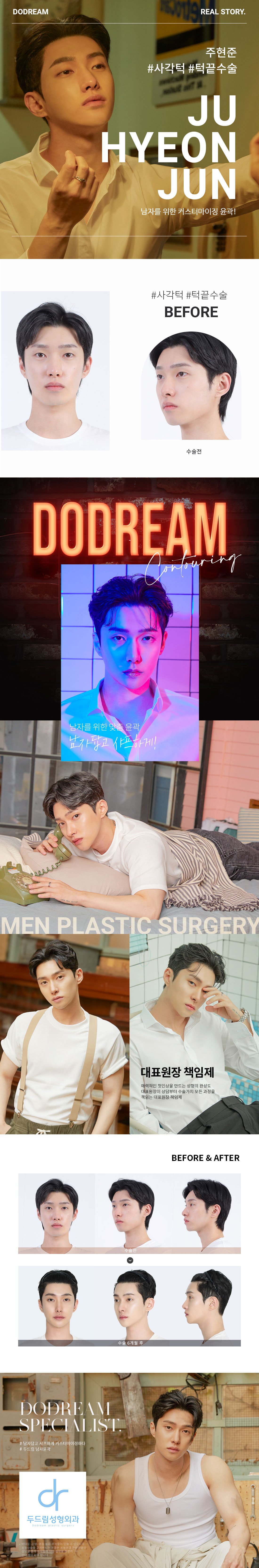200306_주현준(사각턱,턱끝)_리얼스토리.jpg