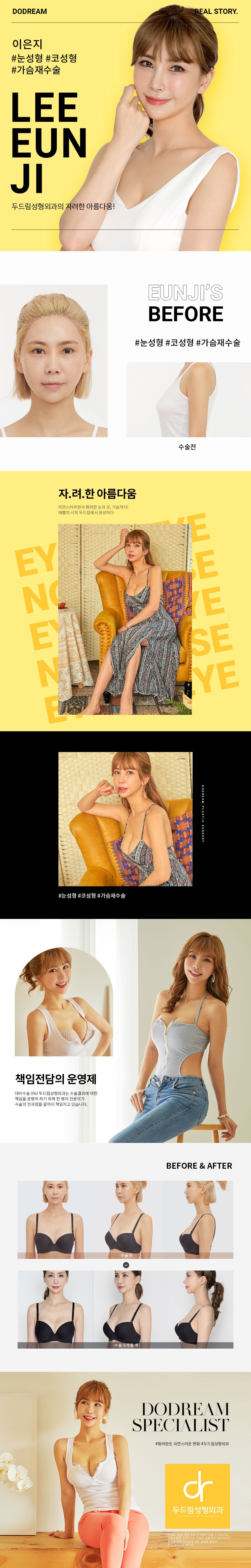 191001_이은지(눈+코+가슴-재수술)_리얼스토리.jpg
