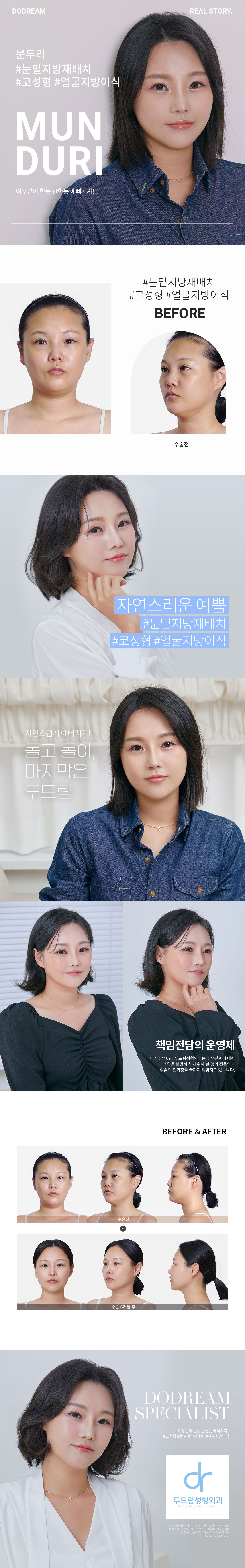 230830_문두리(코,눈밑지,얼지이)_리얼스토리.jpg