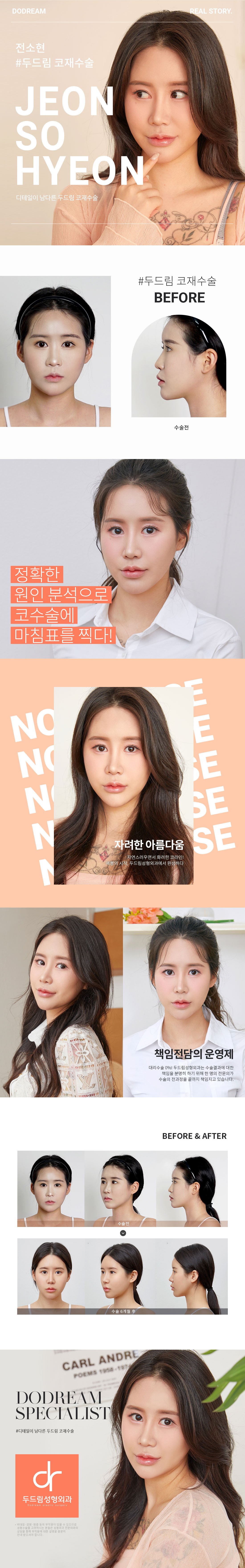 230808_전소현(코재)_리얼스토리.jpg