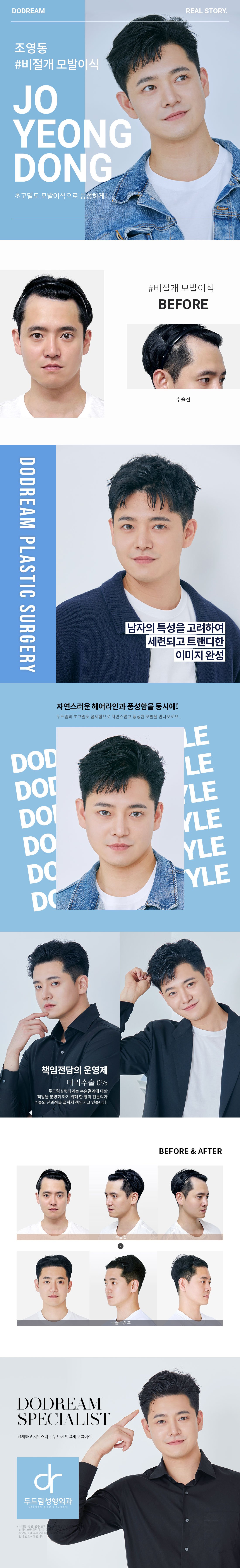 230417_조영동(비절개2500모)_리얼스토리.jpg